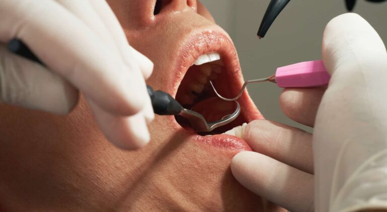 Malayali Dental Clinic Markham