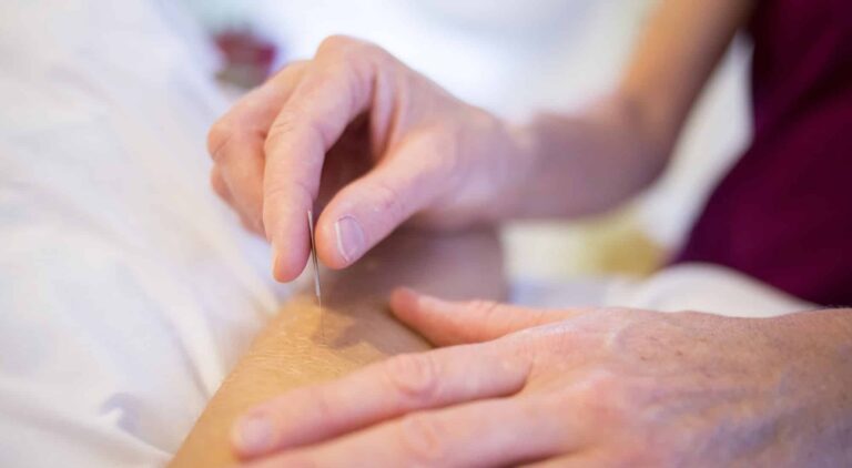 Registered Malayali Acupuncturist Mississauga